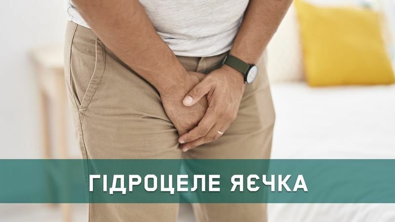 Водянка яєчка (гідроцеле): причини та лікування | Відео Lancet Clinic
