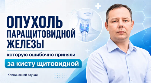 Опухоль паращитовидной железы