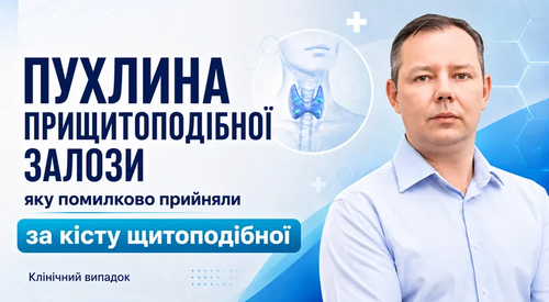 Пухлина прищитоподібної залози