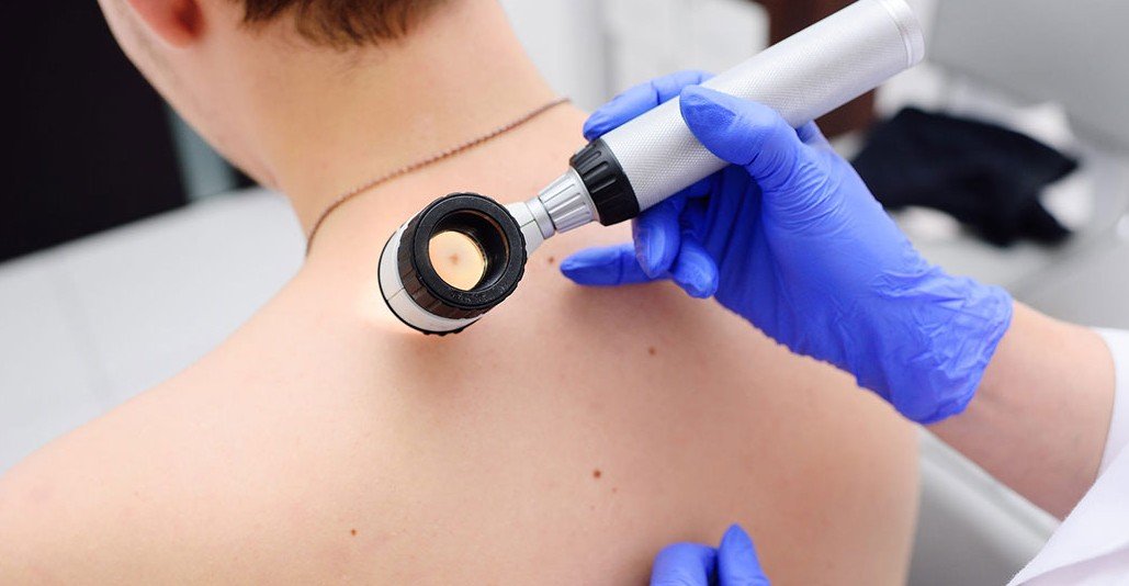 Дерматоскопія