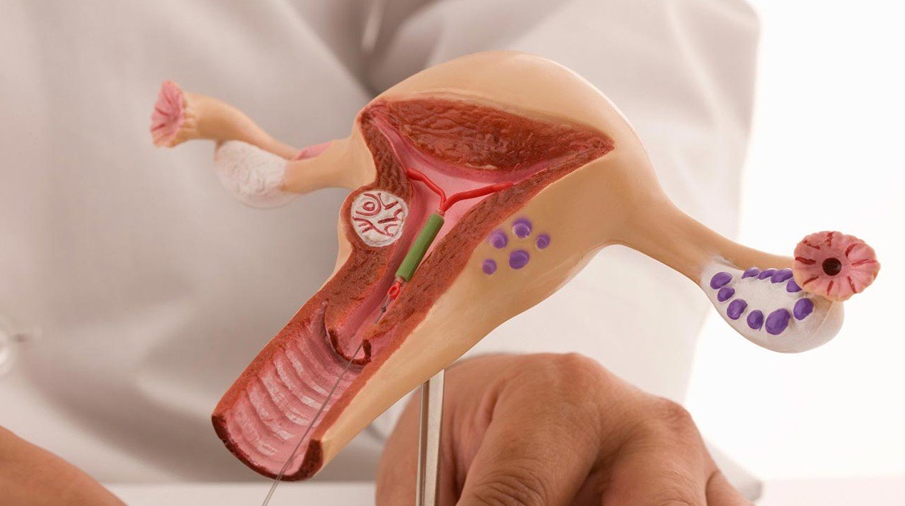 Видалення ВМС