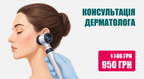 Консультація дерматолога