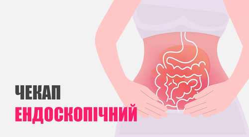 Ендоскопічний чекап