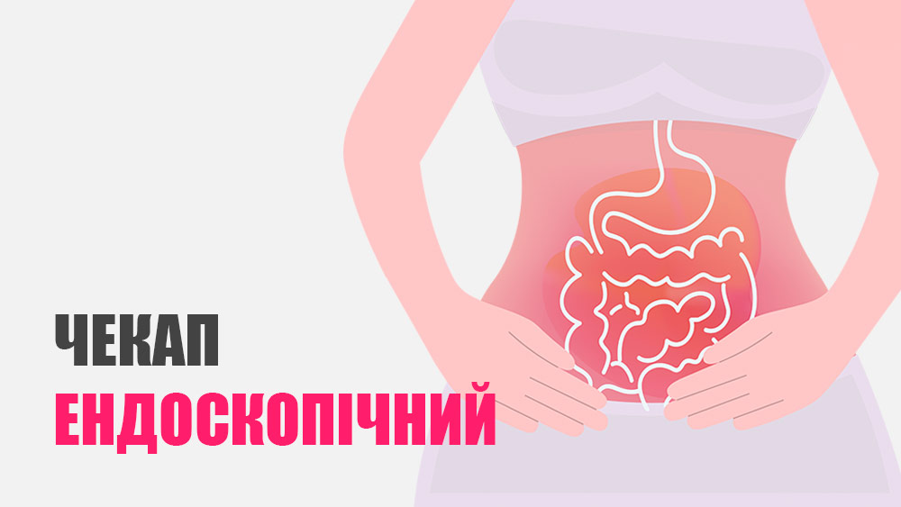 Ендоскопічний чекап