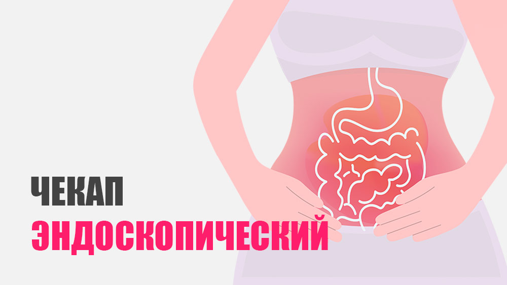 Эндоскопический чекап