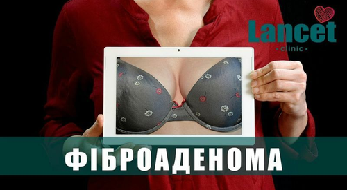 Фиброаденома молочной железы