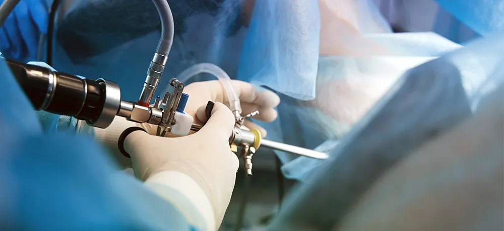 операція гістерорезектоскопія у києві