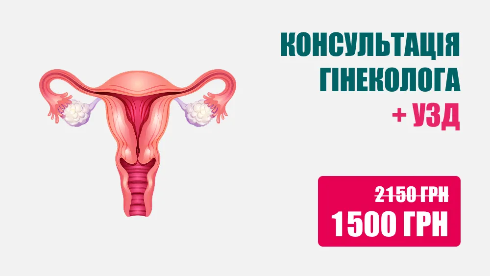 Консультація гінеколога + УЗД