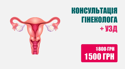 Консультація гінеколога + УЗД