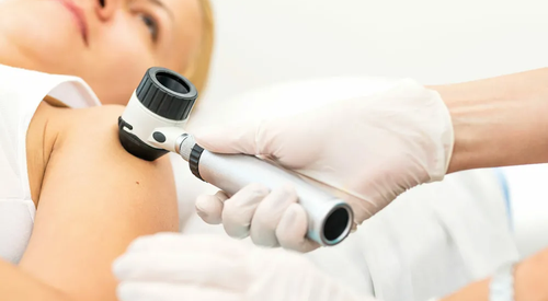 Акция: консультация дерматолога в Киеве за 750 грн