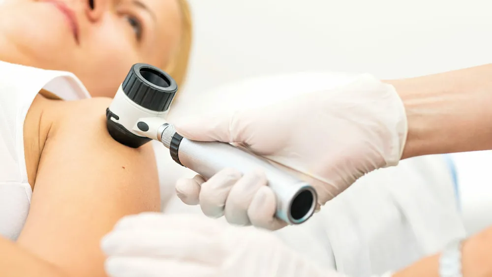 Акция: консультация дерматолога в Киеве за 750 грн