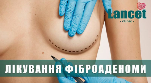 Лікування фіброаденоми молочної залози