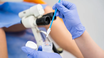 Мазки у гинеколога, Мазки у гінеколога