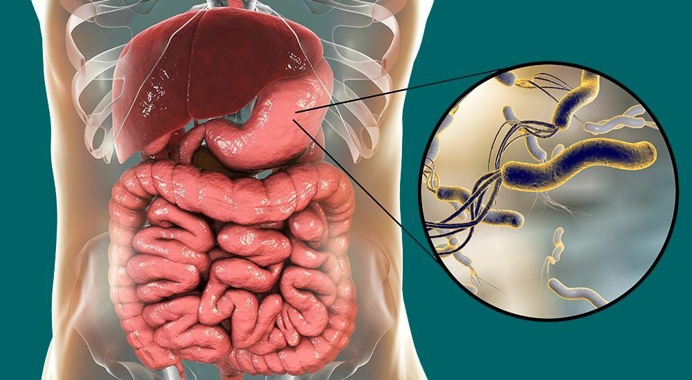 Хеликобактер пилори