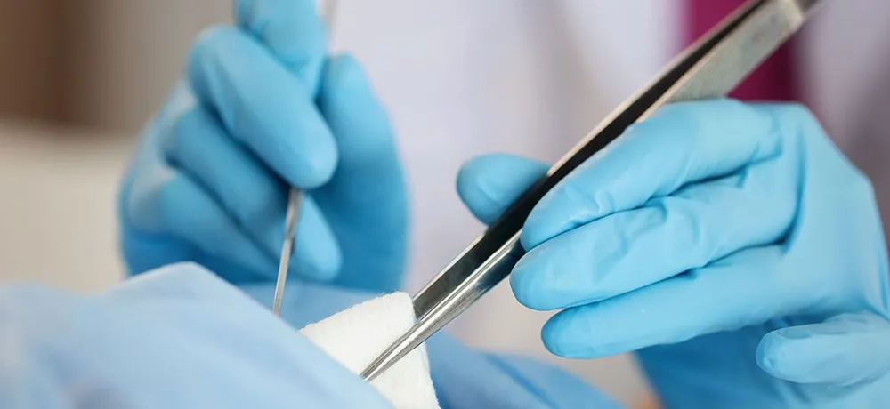 повторное обрезание, коррекция обрезания