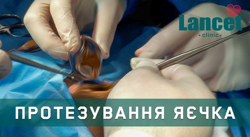 Протезування яєчка: історія пацієнта
