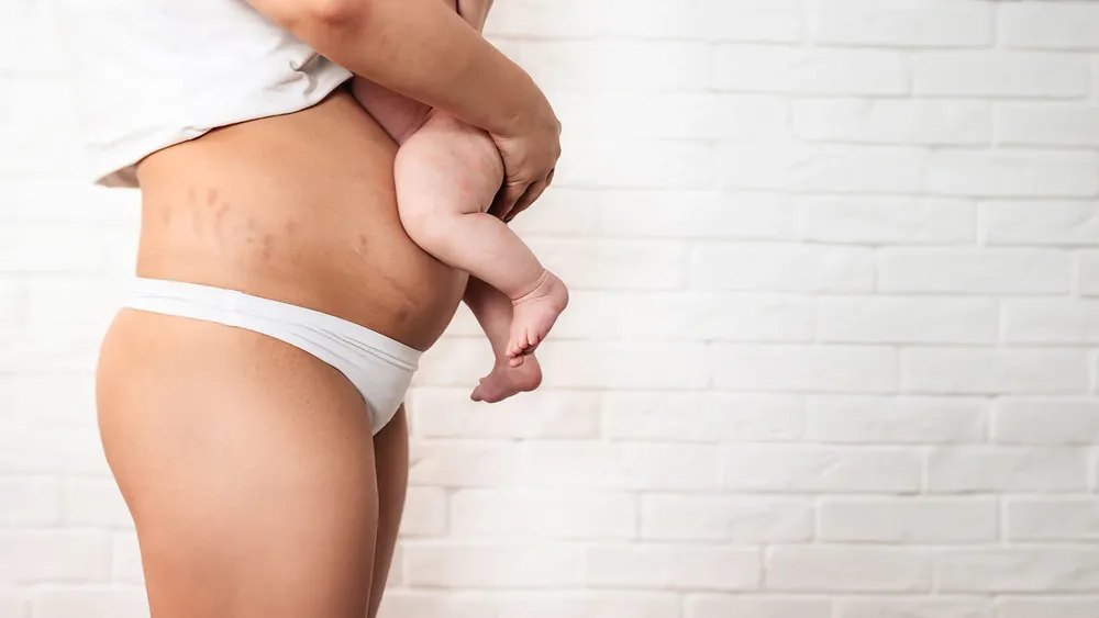 Реабилитация после родов