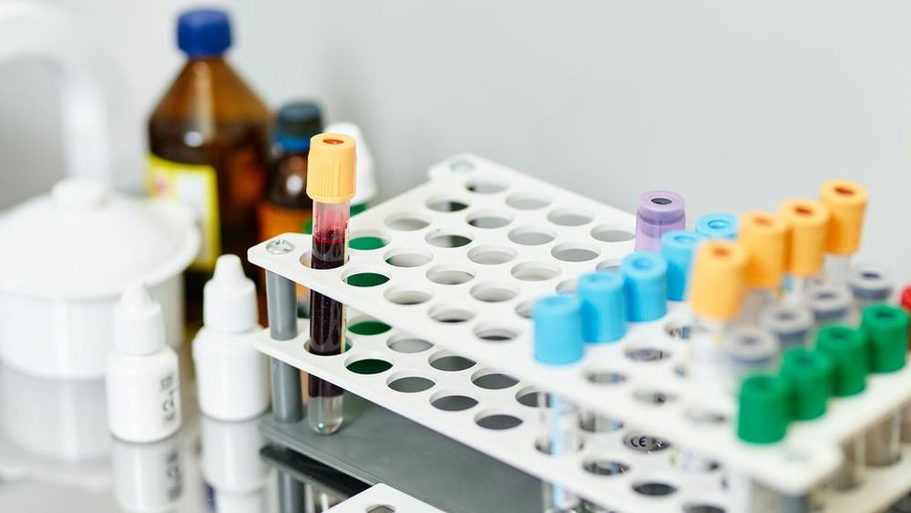 Собственная лаборатория Lancet