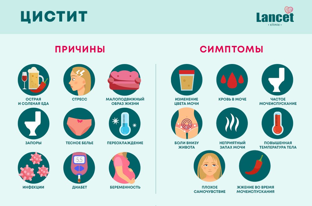 Цистит: причины и симптомы