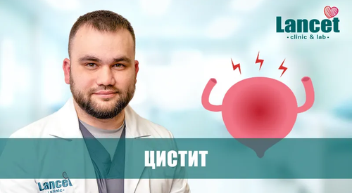 Цистит