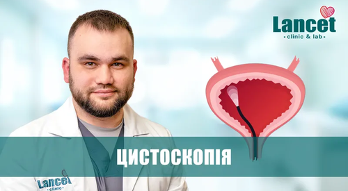 Цистоскопія