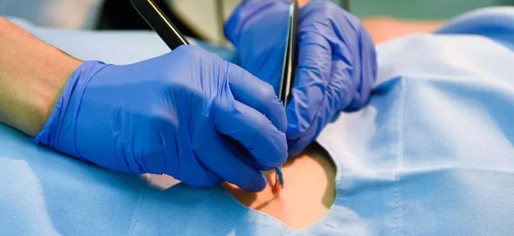 Видалення новоутворень в генітальній зоні