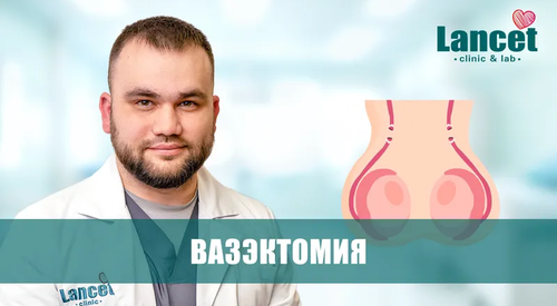 Вазэктомия