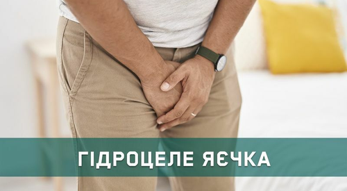 Водянка яєчка (гідроцеле): причини та лікування